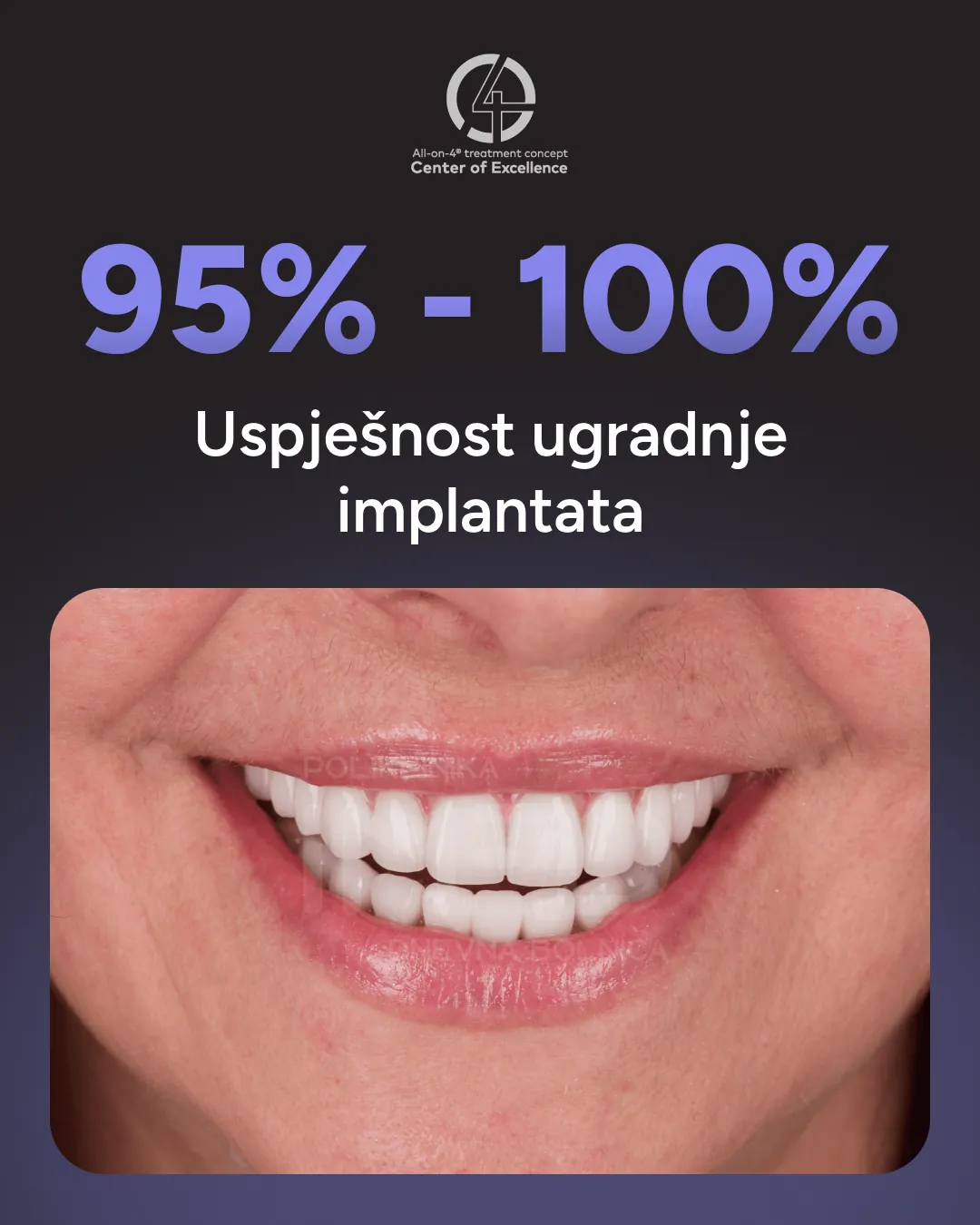 95-100% uspješnost ugradnje implantata — All-on-4 Center of Excellence